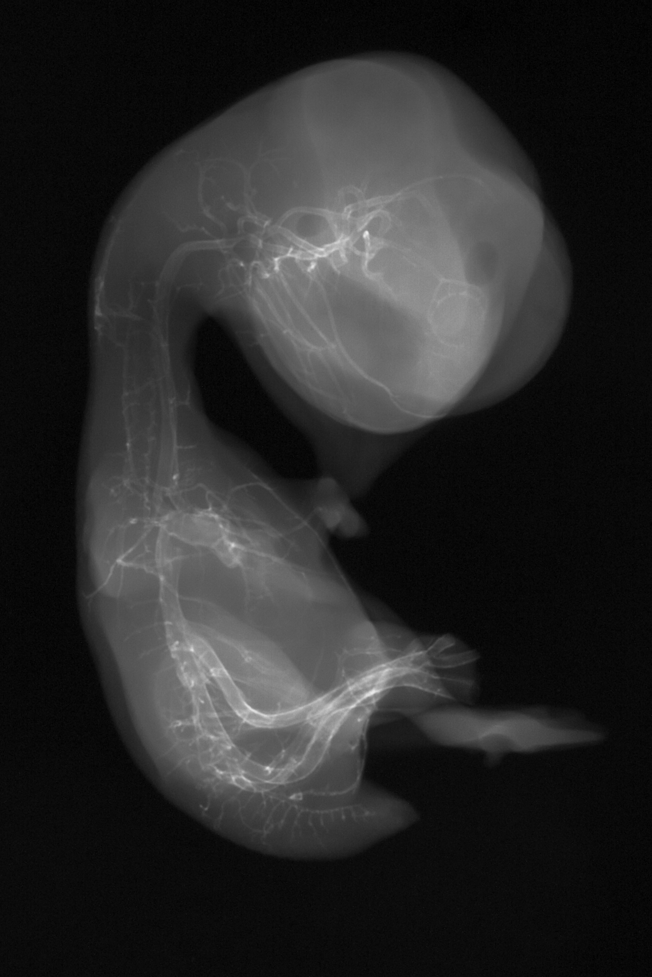 stage 35 chick embryo x-ray